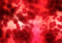 Câncer hematológico: conheça os diferentes tipos da doença