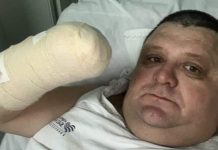 Humorista perde a mão em acidente com foguete