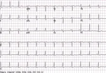 Hospital de Fraiburgo terá que indenizar família de paciente