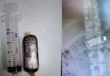 Detento engole celular e é hospitalizado em SC