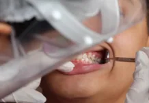 Número de crianças sem cárie cresce no Brasil