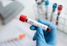 Nova variante do HIV é identificada em três estados brasileiros