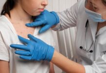 Casos de mpox no Brasil já superam total de 2023