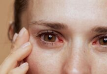 Olhos Secos: entenda causas, sintomas e opções de tratamento