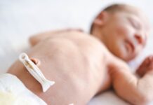 Pesquisa relaciona sangue do cordão umbilical a riscos de autismo