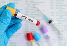 AIDS: diagnóstico tardio continua a ser um problema grave na região