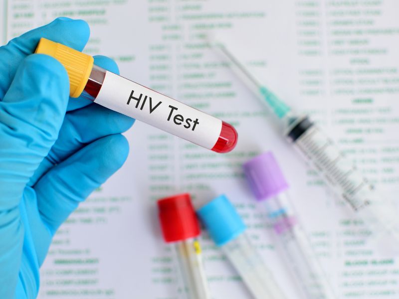 AIDS: diagnóstico tardio continua a ser um problema grave na região
