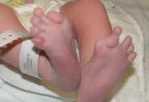 Exame para detectar doença rara em recém-nascido torna-se obrigatório