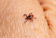 16 casos de febre maculosa são investigados em Santa Catarina