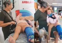 Criança atropelada por carro da Prefeitura de Videira recebe alta