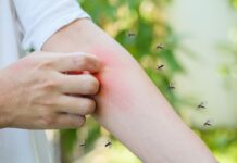 Dengue em Videira: Fumacê e medidas simples ajudam a combater o mosquito