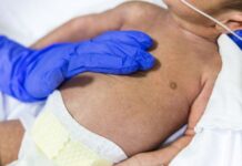 Casos graves de doenças respiratórias disparam em SC