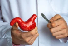 Conselho de Medicina implementa novas regras para a cirurgia bariátrica