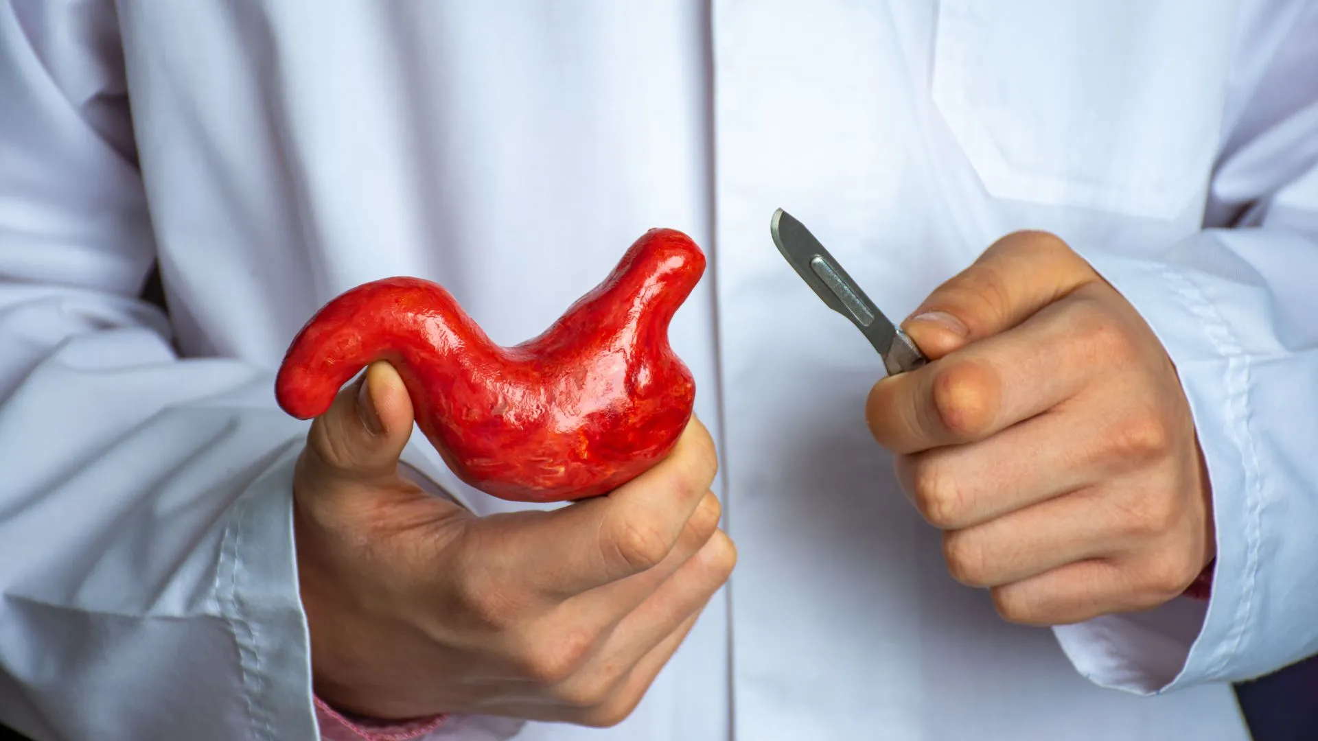 Conselho de Medicina implementa novas regras para a cirurgia bariátrica