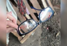 Idoso de 81 anos fica gravemente ferido durante assalto no Meio-Oeste