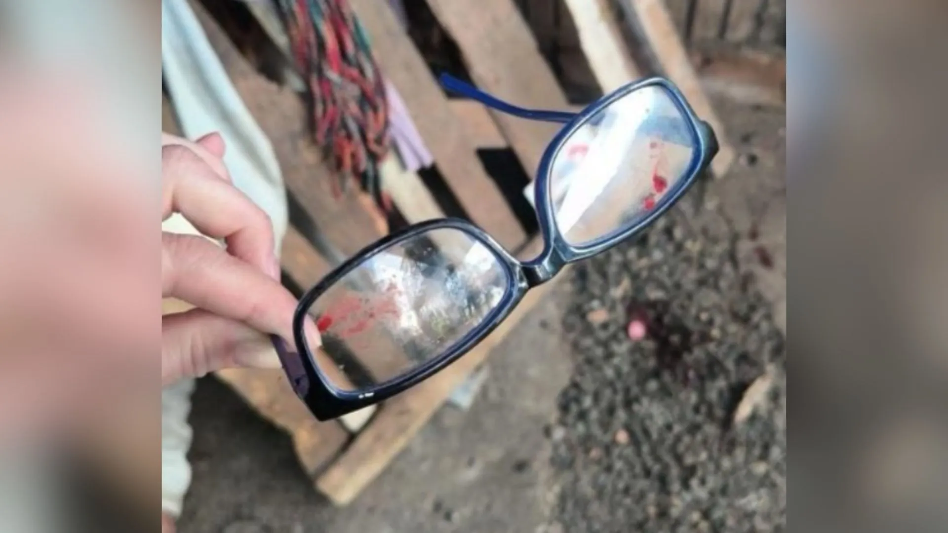 Idoso de 81 anos fica gravemente ferido durante assalto no Meio-Oeste