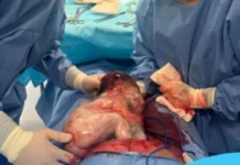 Bebê nasce dentro da bolsa amniótica em hospital de Videira