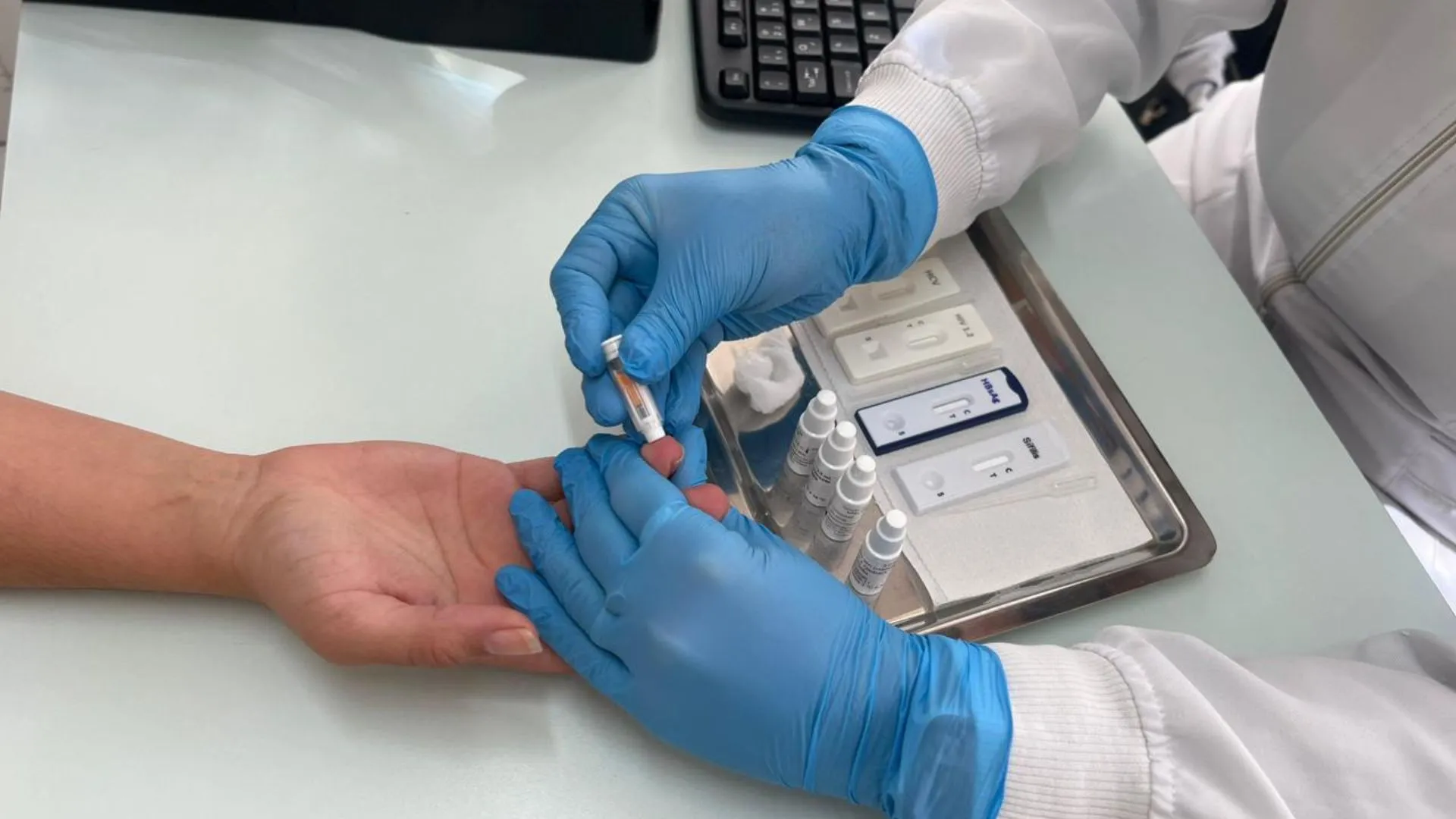 UBSs de Caçador oferecem testes rápidos para HIV, sífilis e hepatites