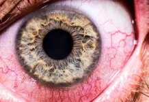 Por que o metanol pode causar cegueira? Veja como o nervo óptico é afetado