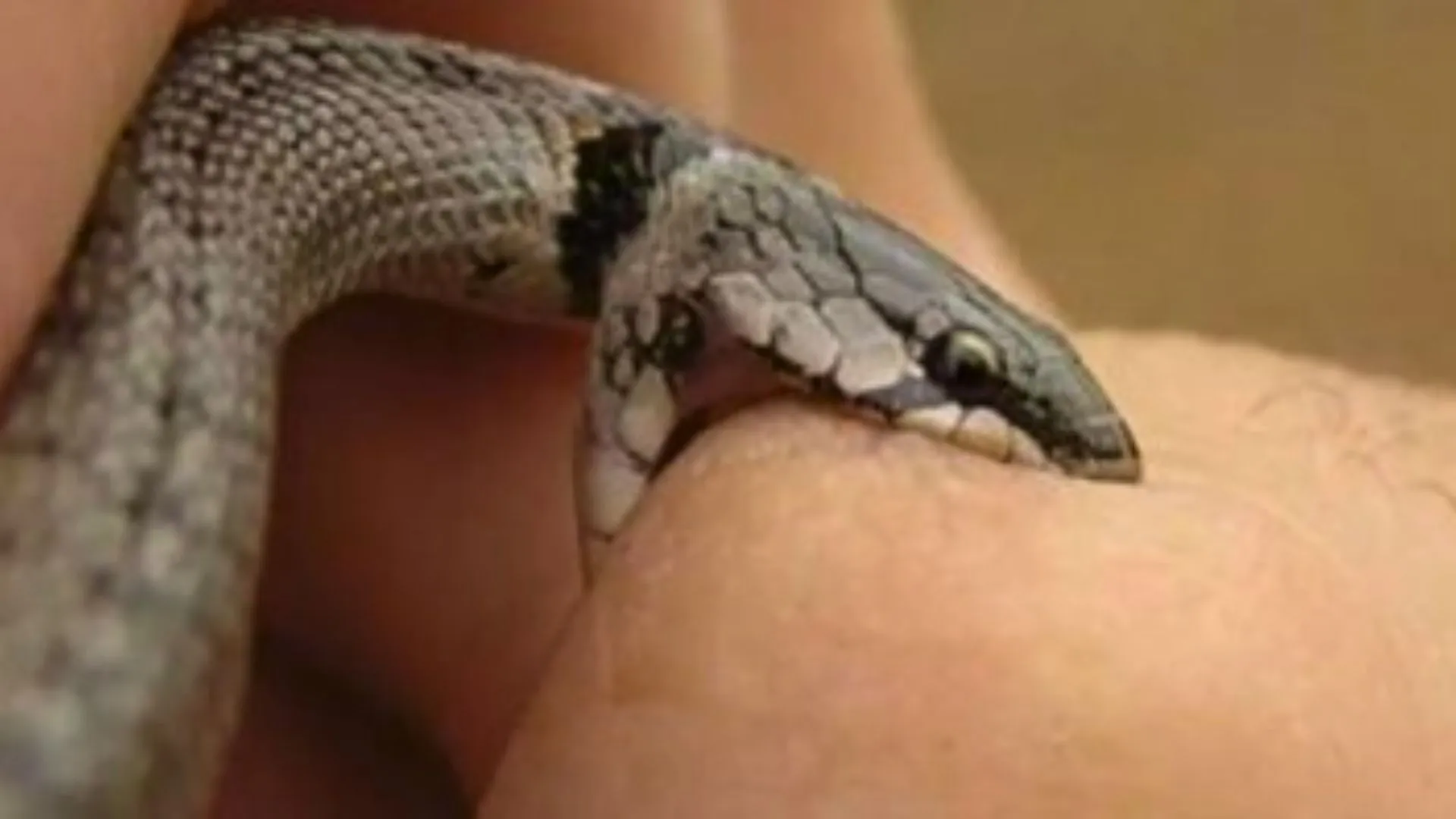 Hospital Salvatoriano atende mais um caso de acidente com animal peçonhento em Videira