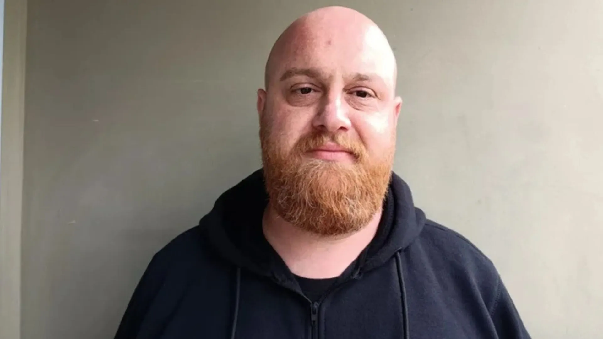 Caçadorense lança vakinha virtual para tratar necrose no quadril