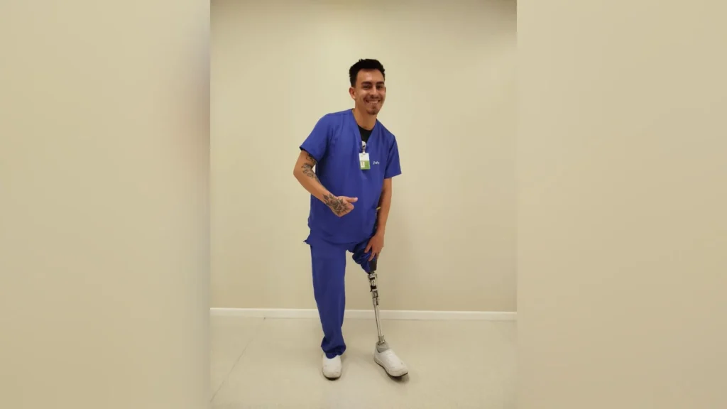 Jovem de Caçador precisa de ajuda para trocar prótese após grave acidente