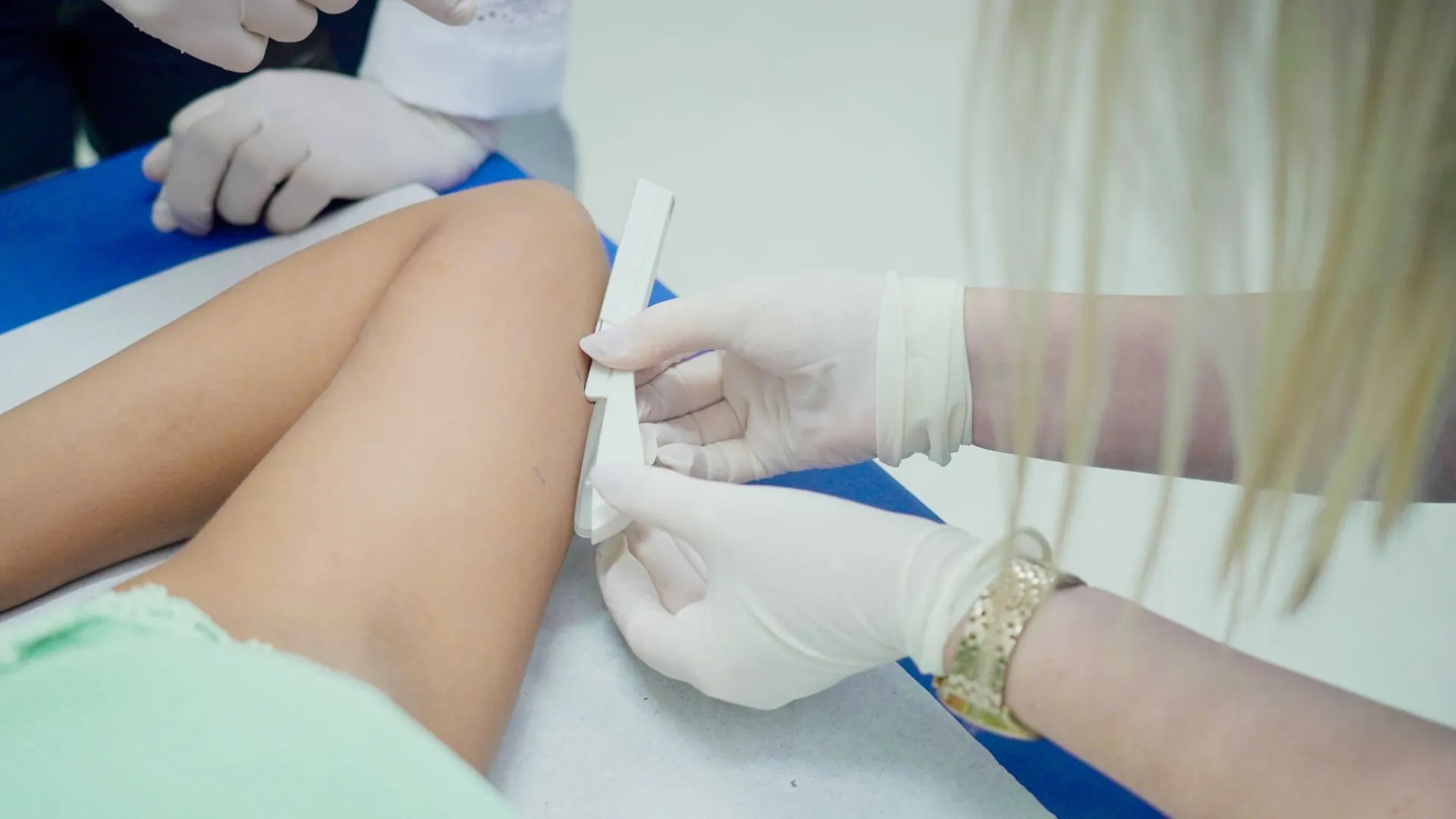 Videira passa a oferecer implante contraceptivo de graça para mulheres