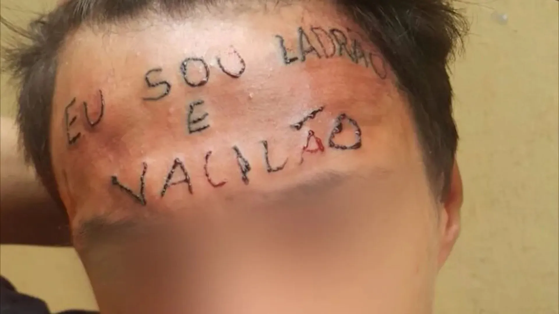 Jovem que teve testa tatuada com frase 'eu sou ladrão e vacilão' é preso novamente