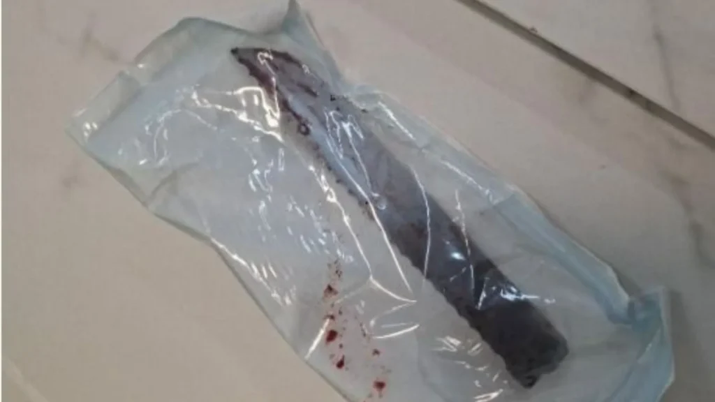 Homem que cravou faca no crânio de mulher é preso