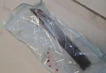 Homem que cravou faca no crânio de mulher é preso