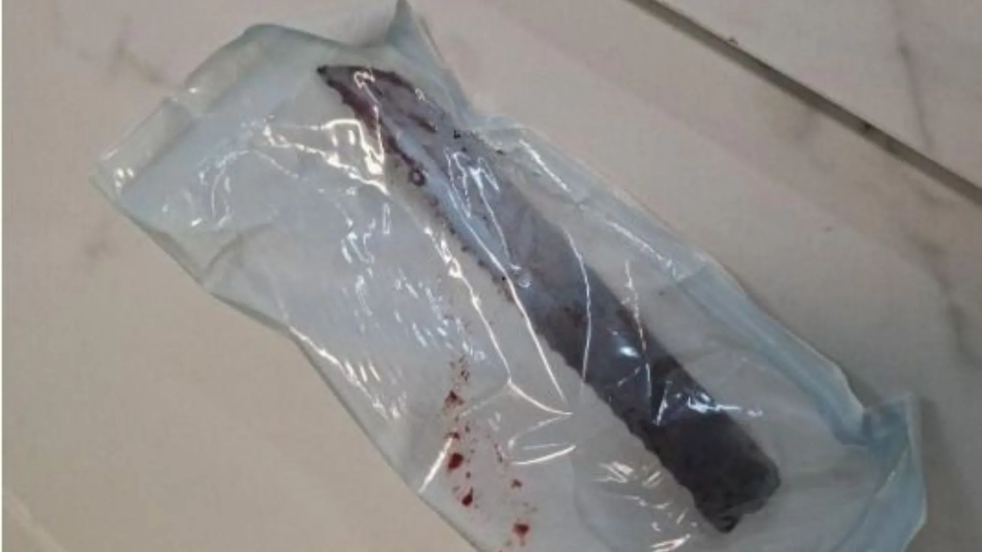 Homem que cravou faca no crânio de mulher é preso