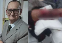 Trabalhador fica gravemente ferido após ataque de pitbull