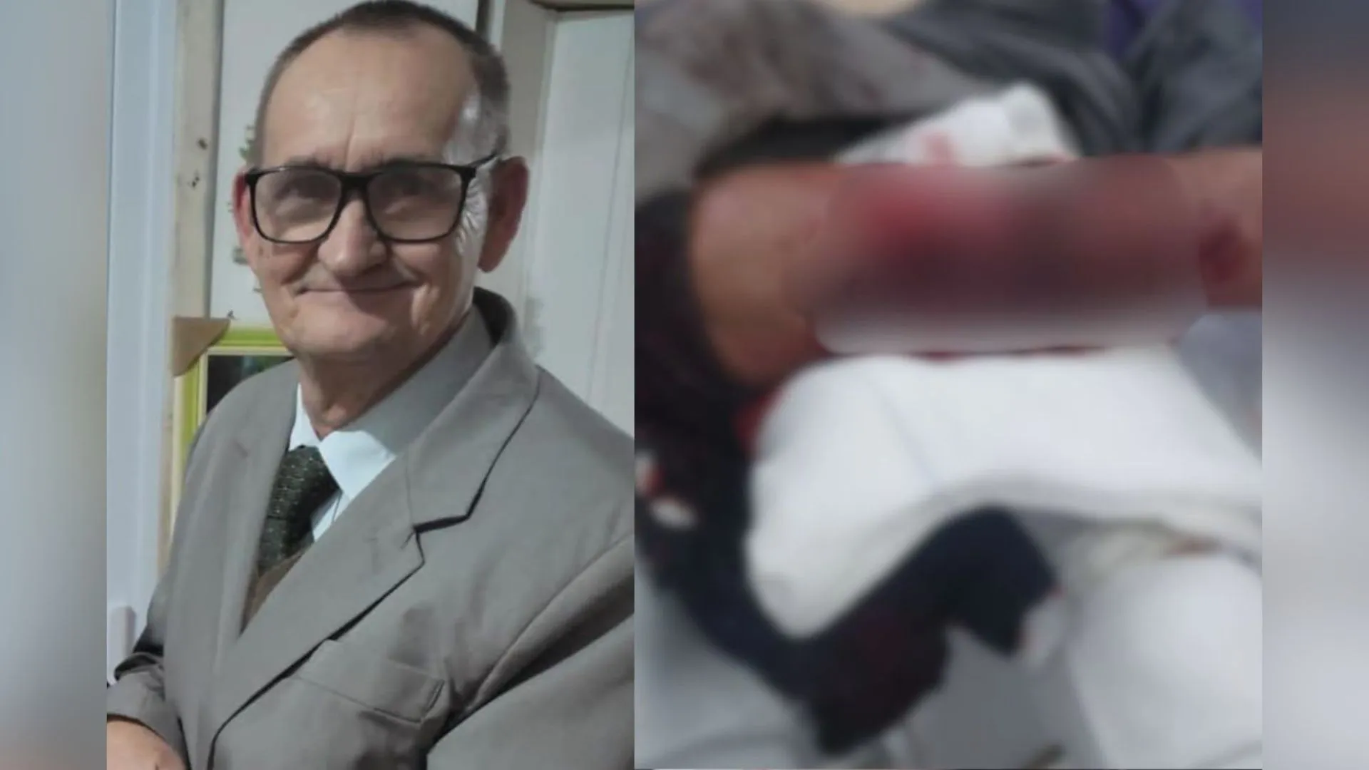 Trabalhador fica gravemente ferido após ataque de pitbull