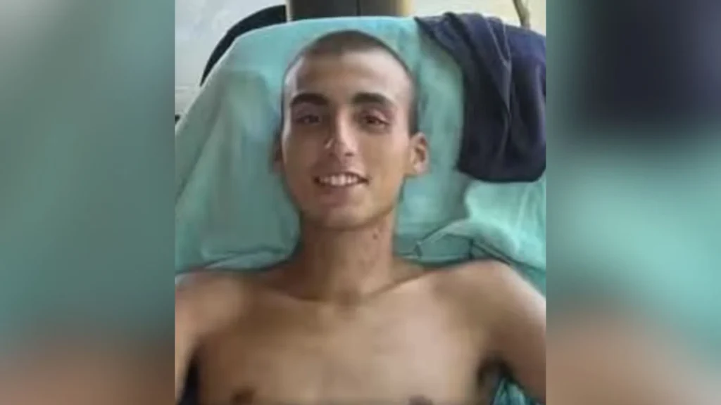 Jovem se torna o primeiro catarinense a receber tratamento experimental com polilaminina