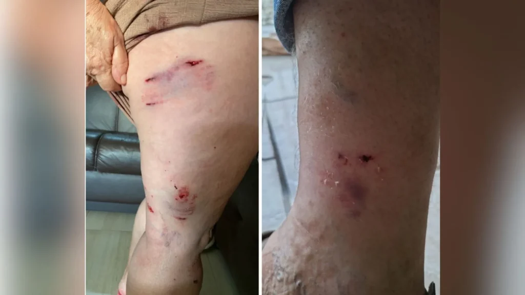 Vereador cobra providências após ataques de cães de rua em Caçador