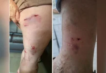 Vereador cobra providências após ataques de cães de rua em Caçador