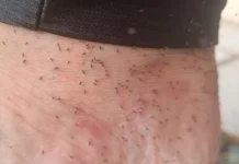 Moradores de SC vivem pesadelo com infestação de mosquitos Moradores de SC vivem pesadelo com infestação do mosquito