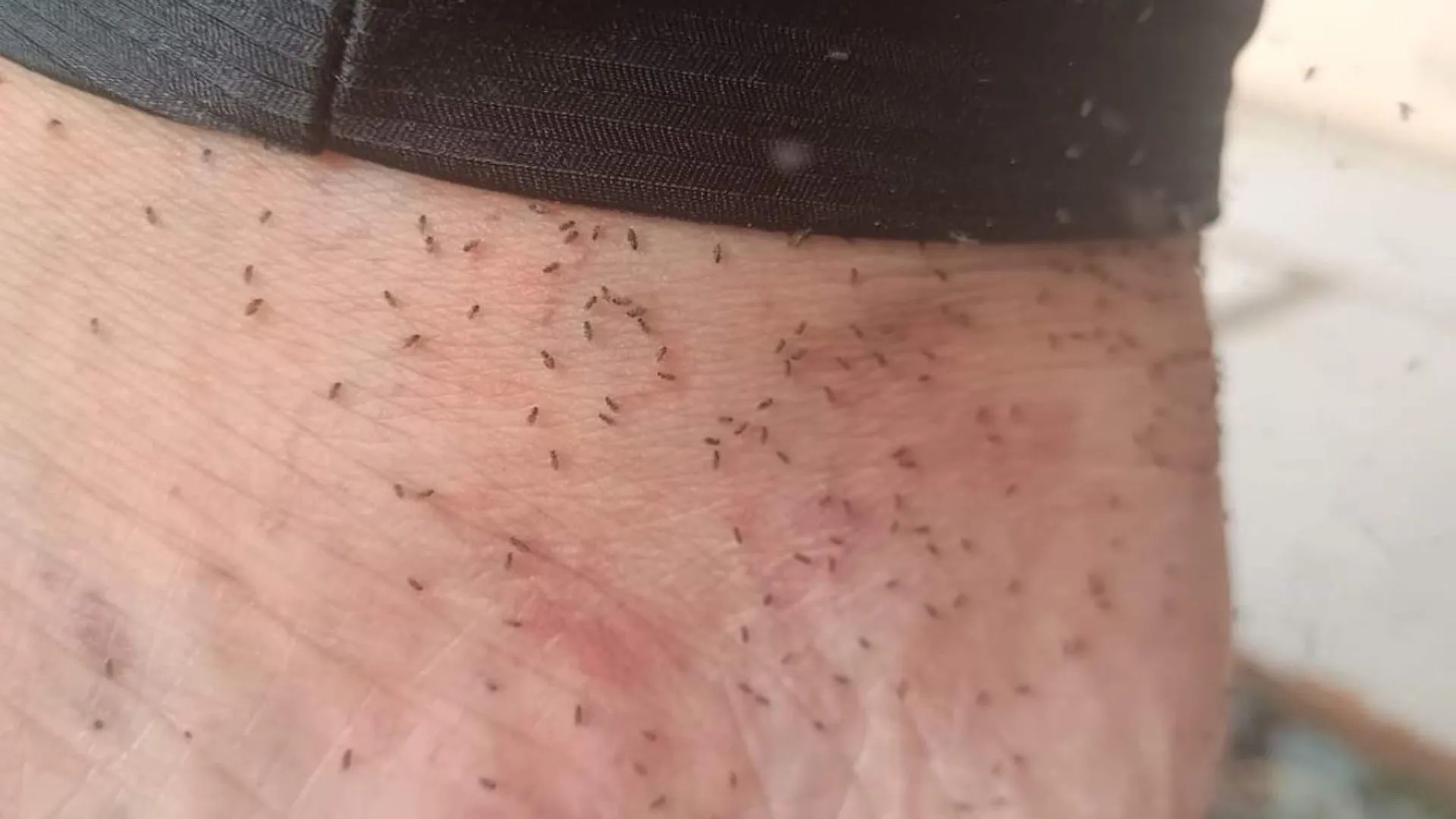 Moradores de SC vivem pesadelo com infestação do mosquito