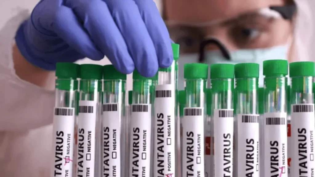 Estado registra caso de hantavirose e reforça alerta de prevenção