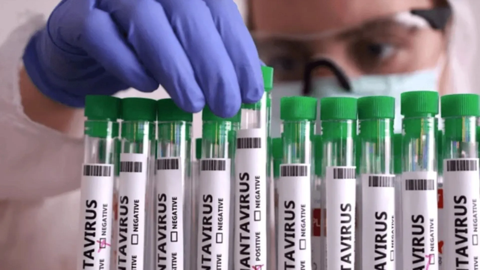 Estado registra caso de hantavirose e reforça alerta de prevenção