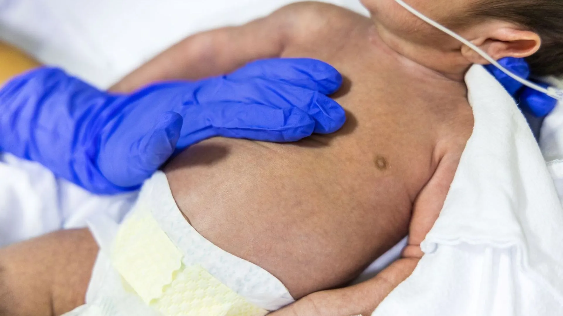 Casos graves de doenças respiratórias disparam em SC